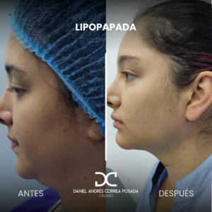 NUEVO FEED DR. CORREA-33