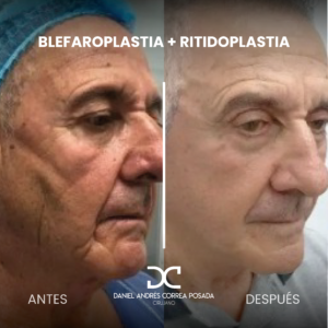 NUEVO FEED DR. CORREA-34