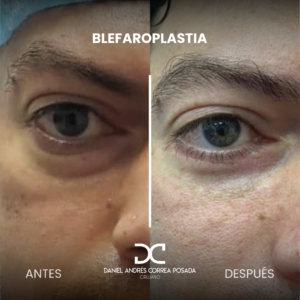 NUEVO FEED DR. CORREA-35