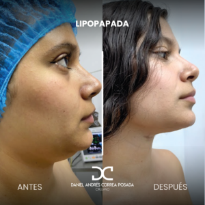 NUEVO FEED DR. CORREA-36