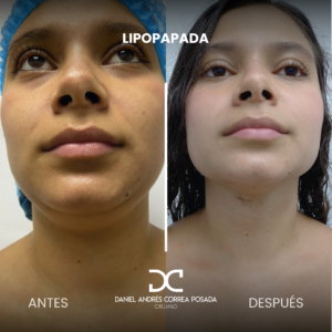 NUEVO FEED DR. CORREA-37