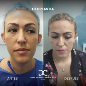 NUEVO FEED DR. CORREA-39