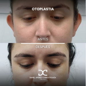 NUEVO FEED DR. CORREA-40