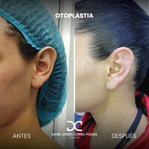 NUEVO FEED DR. CORREA-41