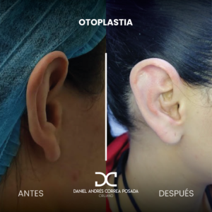 NUEVO FEED DR. CORREA-42