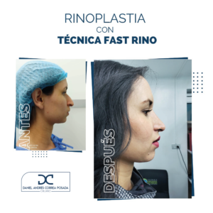 NUEVO FEED DR. CORREA-43