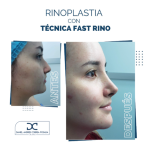 NUEVO FEED DR. CORREA-44