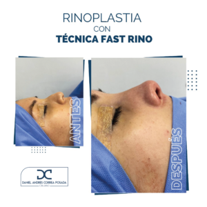 NUEVO FEED DR. CORREA-45