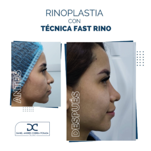 NUEVO FEED DR. CORREA-46