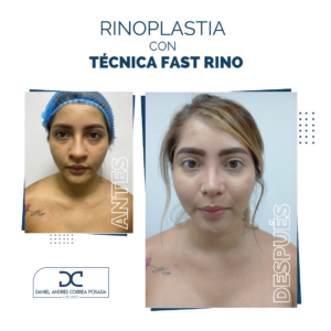 NUEVO FEED DR. CORREA-47