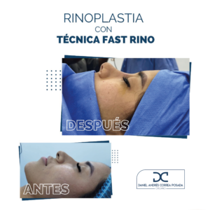 NUEVO FEED DR. CORREA-48