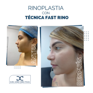 NUEVO FEED DR. CORREA-49